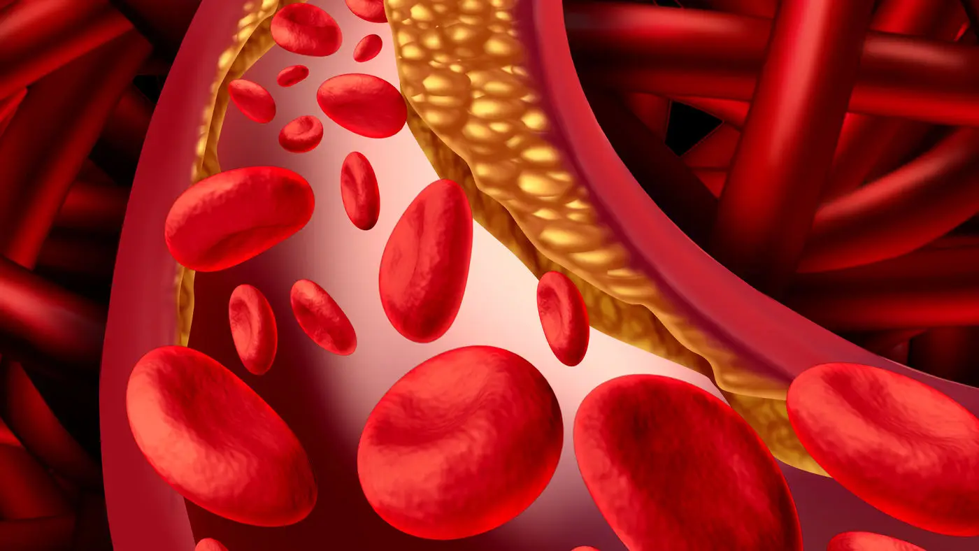 Come ridurre il colesterolo in 7 giorni: il piano alimentare che protegge cuore e arterie Come ridurre il colesterolo in 7 giorni: il piano alimentare che protegge cuore e arterie